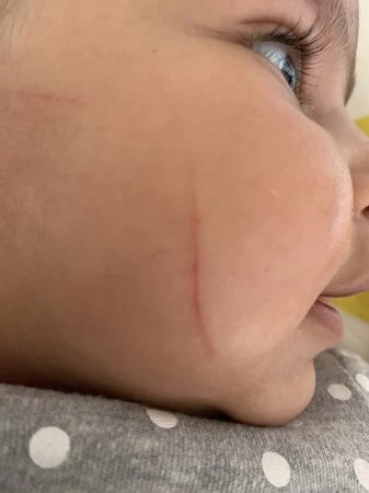 👶 Baby Nail Trimmer 👶